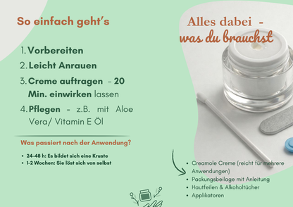 Creamole - 100% natürliche Creme zur Entfernung von Muttermalen, Leberflecken & Warzen