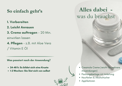 Creamole - Natürliche Creme zur Entfernung von Muttermalen, Leberflecken & Warzen